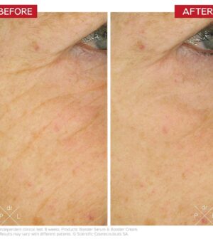 Dr. Levy "Booster Cream" senėjimo požymius mažinantis veido kremas 50 ml